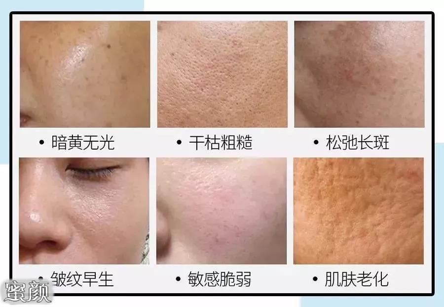 https://img.yiyiaimei.com/mnt/Editor/2020-11-19/5fb6494aedf87.jpg