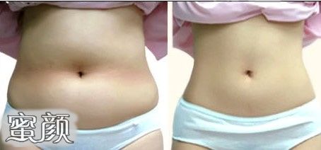 https://img.yiyiaimei.com/mnt/Editor/2020-11-22/5fb9a6a30a5d7.jpg