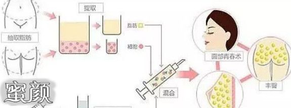 https://img.yiyiaimei.com/mnt/Editor/2020-11-23/5fbaf1014a5b3.jpg