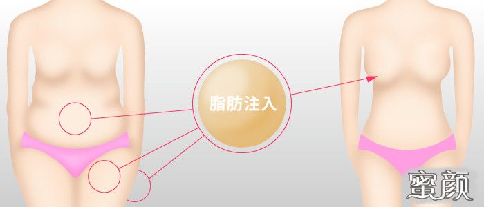 https://img.yiyiaimei.com/mnt/Editor/2020-11-23/5fbaf55681cf1.jpg