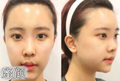 https://img.yiyiaimei.com/mnt/Editor/2020-11-23/5fbb88e3e9678.jpg