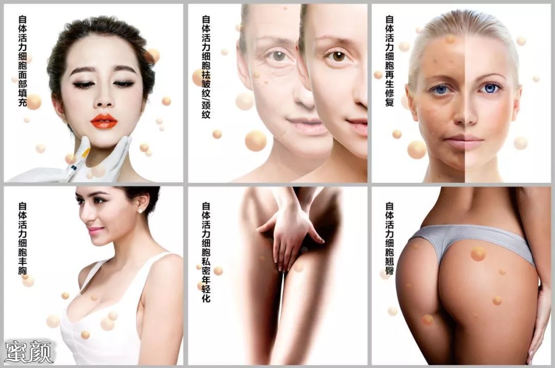 https://img.yiyiaimei.com/mnt/Editor/2020-11-23/5fbb890d09398.jpg