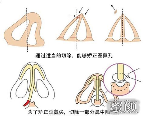 案例图片