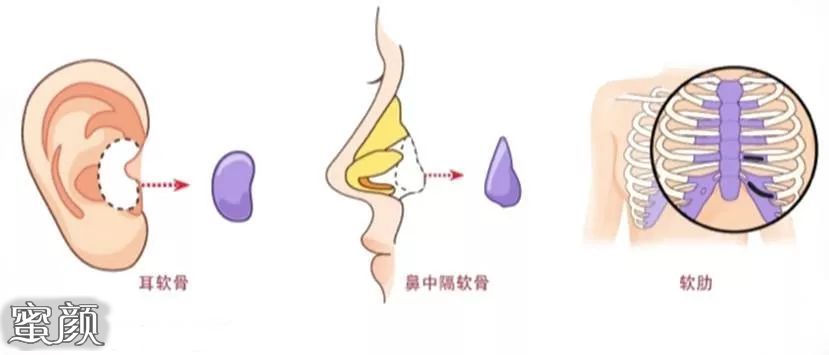 案例图片