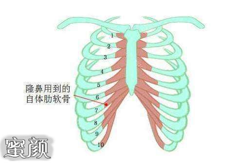 案例图片