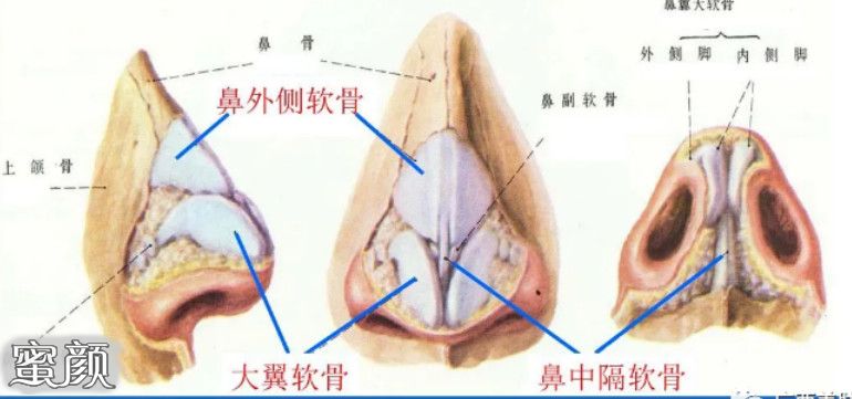 案例图片