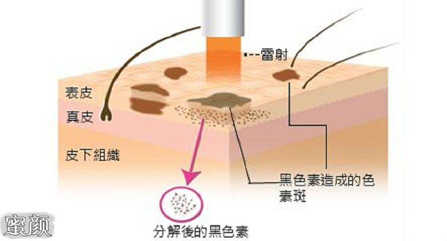 案例图片