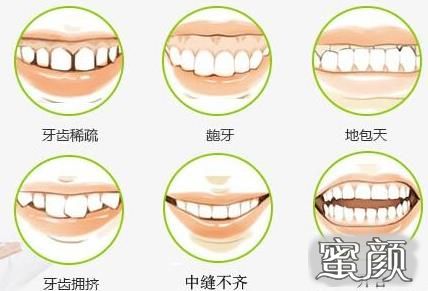 https://img.yiyiaimei.com/mnt/Editor/2020-11-28/5fc1c8eed57e9.jpg