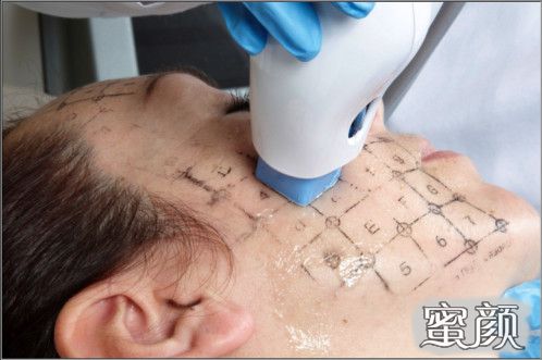 案例图片
