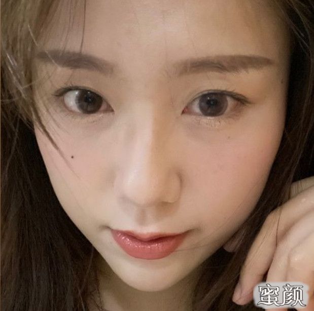 案例图片