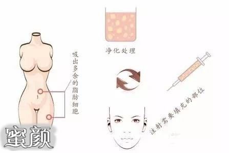 案例图片