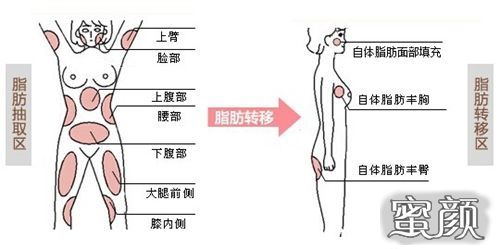 案例图片