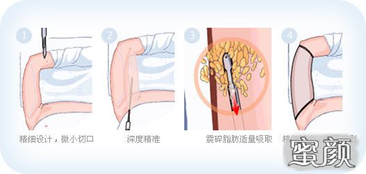 案例图片