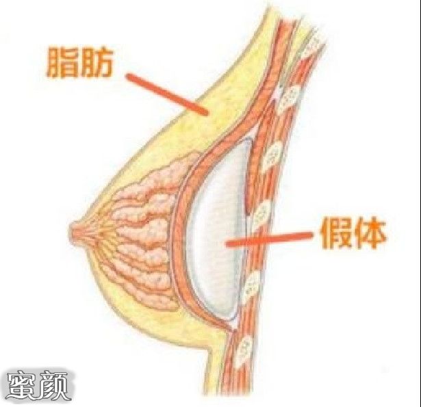 案例图片