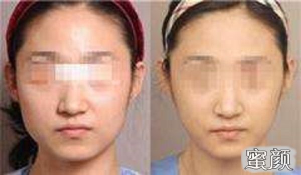 https://img.yiyiaimei.com/mnt/Editor/2020-12-02/5fc790ce0ecfc.jpg