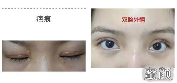 案例图片
