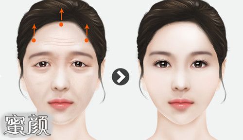 https://img.yiyiaimei.com/mnt/Editor/2020-12-02/5fc79a8b4f4cb.jpg