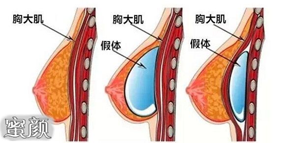 案例图片