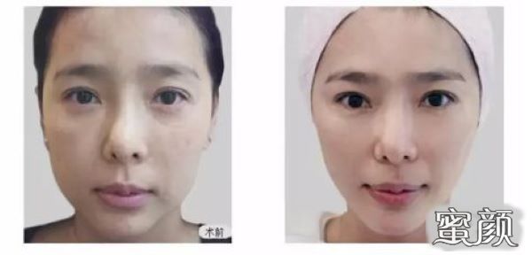 https://img.yiyiaimei.com/mnt/Editor/2020-12-03/5fc85ef2af0dc.jpg