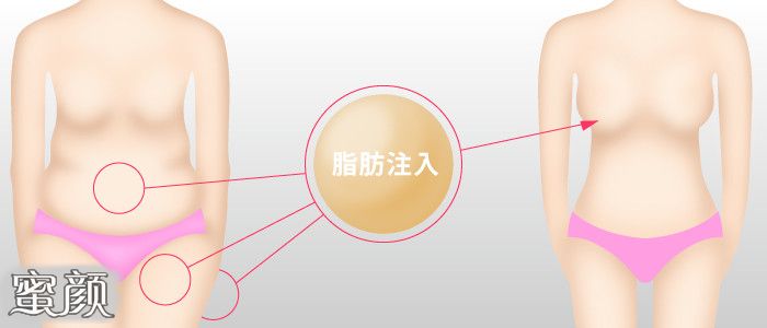 https://img.yiyiaimei.com/mnt/Editor/2020-12-03/5fc8d6ab751c7.jpg