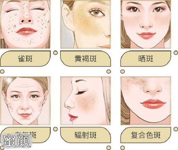 案例图片