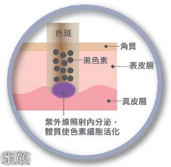 案例图片