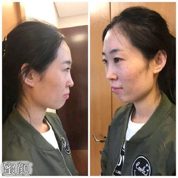 案例图片