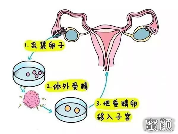 https://img.yiyiaimei.com/mnt/Editor/2020-12-08/5fcf219a73c49.jpg
