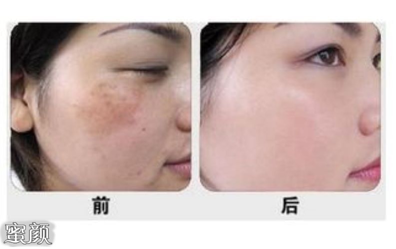 https://img.yiyiaimei.com/mnt/Editor/2020-12-08/5fcf6b7595155.jpg