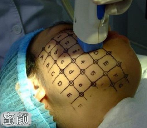 https://img.yiyiaimei.com/mnt/Editor/2020-12-08/5fcf74971e1f1.jpg