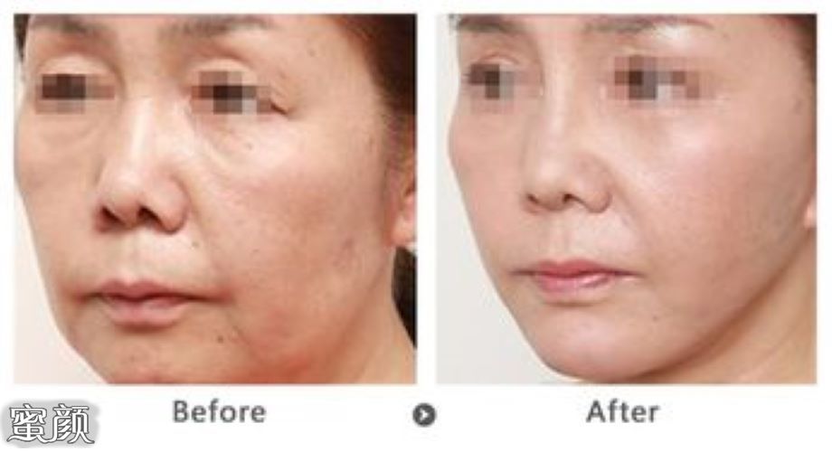 https://img.yiyiaimei.com/mnt/Editor/2020-12-09/5fd068210209c.jpg