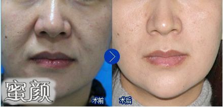 https://img.yiyiaimei.com/mnt/Editor/2020-12-09/5fd0b59f0a942.jpg