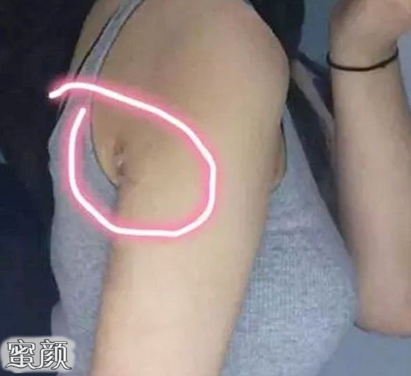 案例图片