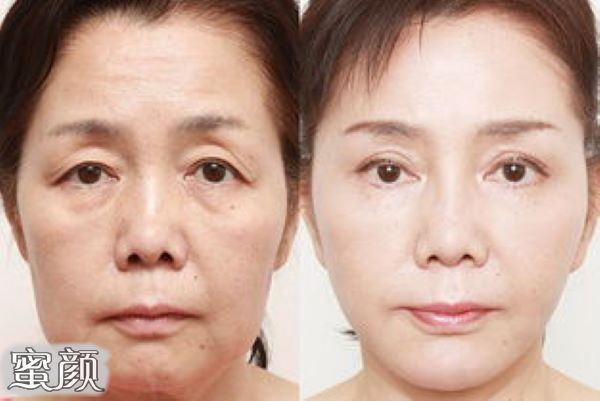 https://img.yiyiaimei.com/mnt/Editor/2020-12-11/5fd2e13593338.jpg