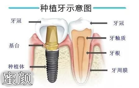 案例图片