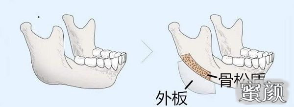 案例图片