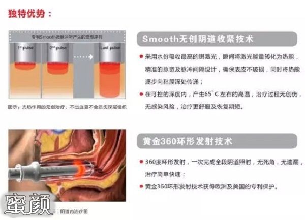 案例图片