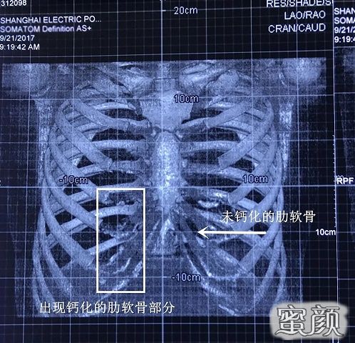 案例图片