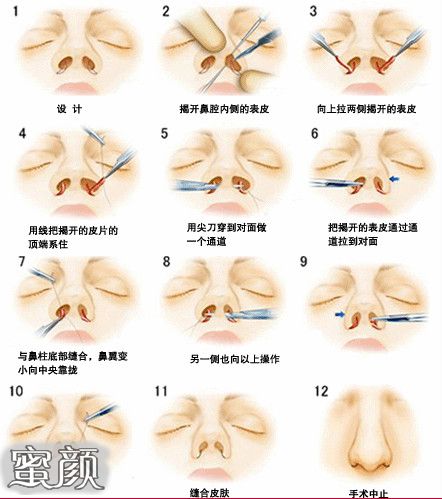 案例图片