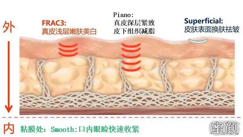 案例图片