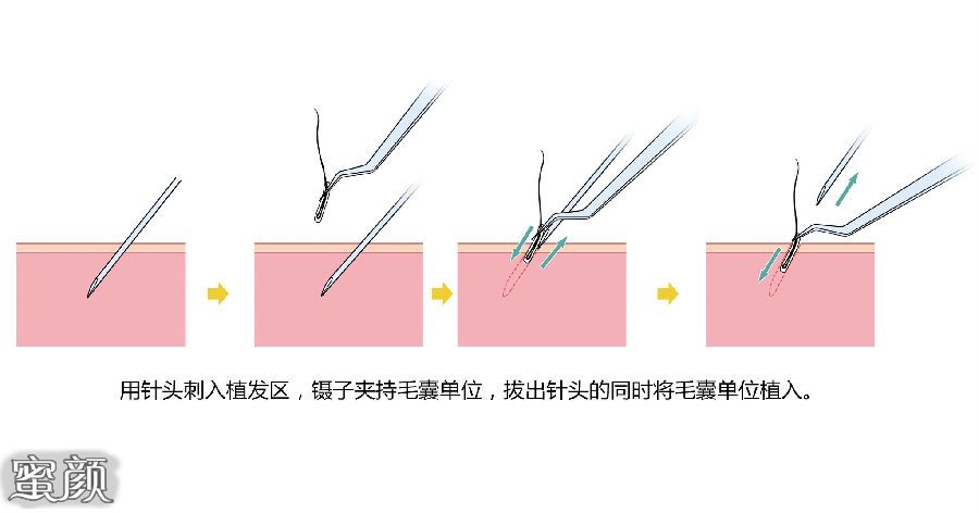 案例图片