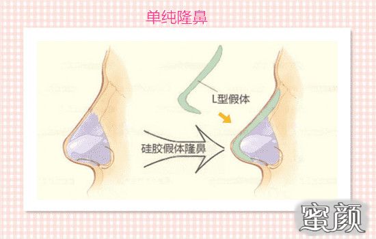 案例图片