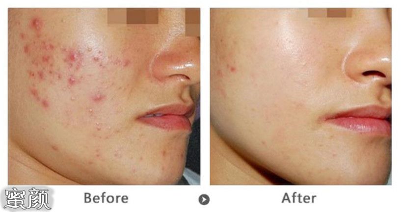 https://img.yiyiaimei.com/mnt/Editor/2020-12-16/5fda064f71d6b.jpg