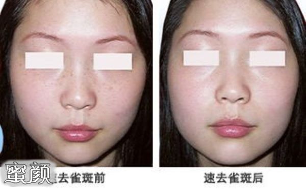 https://img.yiyiaimei.com/mnt/Editor/2020-12-16/5fda06cb39dc4.jpg