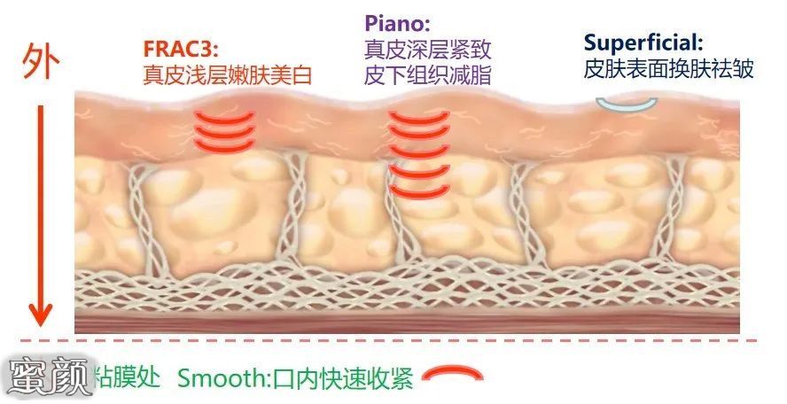 案例图片