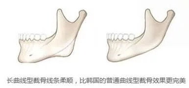 案例图片