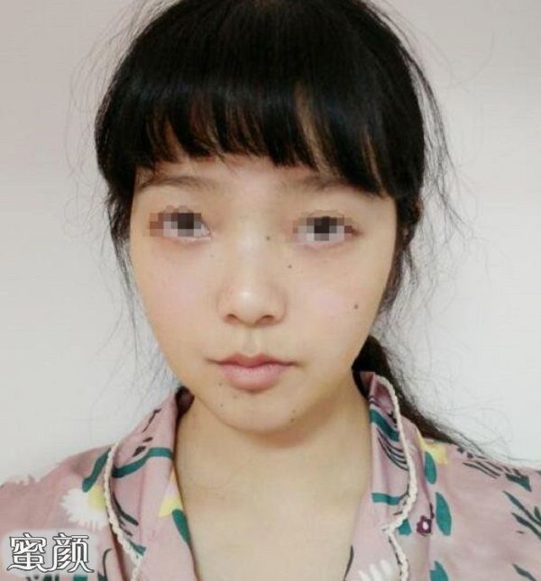 案例图片