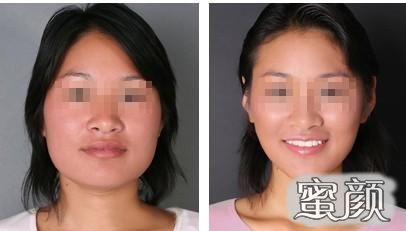 https://img.yiyiaimei.com/mnt/Editor/2020-12-20/5fded54c0bbc7.jpg