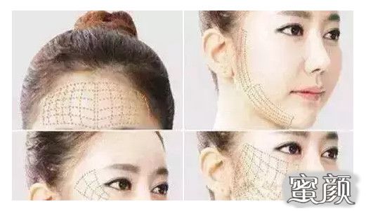 https://img.yiyiaimei.com/mnt/Editor/2020-12-22/5fe1d854657e8.jpg