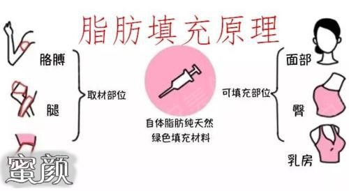 案例图片